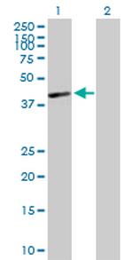 HLA-C Antibody in Western Blot (WB)