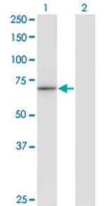 HLX1 Antibody in Western Blot (WB)