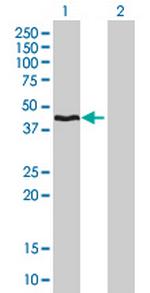 HMBS Antibody in Western Blot (WB)