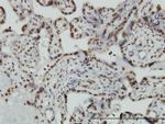 HMGB2 Antibody in Immunohistochemistry (Paraffin) (IHC (P))