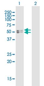 HMGCS2 Antibody in Western Blot (WB)