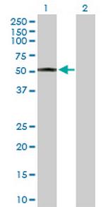 HMGCS2 Antibody in Western Blot (WB)