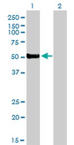 FOXA2 Antibody in Western Blot (WB)