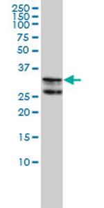 HNRNPA2B1 Antibody in Western Blot (WB)