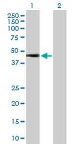 HOXA1 Antibody in Western Blot (WB)