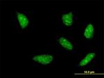 HOXA5 Antibody in Immunocytochemistry (ICC/IF)