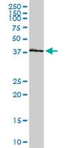 HOXA11 Antibody in Western Blot (WB)