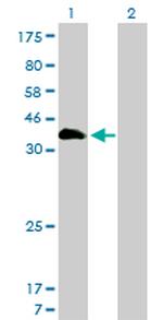 HOXA11 Antibody in Western Blot (WB)