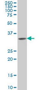 HOXA11 Antibody in Western Blot (WB)