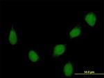 HOXB7 Antibody in Immunocytochemistry (ICC/IF)