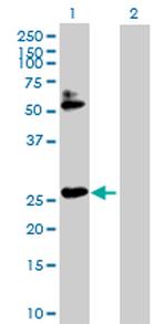 HOXB7 Antibody in Western Blot (WB)