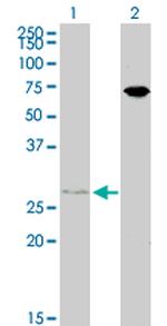 HOXB7 Antibody in Western Blot (WB)