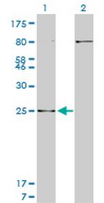 HOXB7 Antibody in Western Blot (WB)