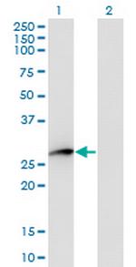 HPGD Antibody in Western Blot (WB)