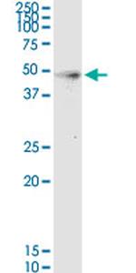 HPN Antibody in Western Blot (WB)