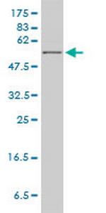 HPRT1 Antibody in Western Blot (WB)