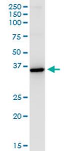 HSD11B1 Antibody in Western Blot (WB)