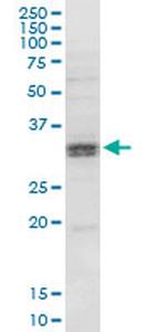 HSD11B1 Antibody in Western Blot (WB)