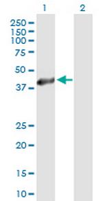 HSD11B2 Antibody in Western Blot (WB)