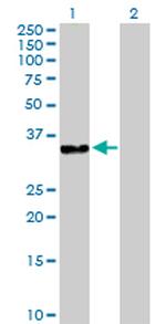 DNAJB2 Antibody in Western Blot (WB)