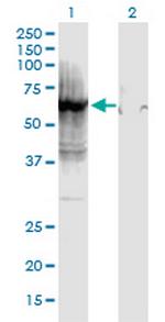 HSPD1 Antibody in Western Blot (WB)