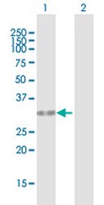 HUS1 Antibody in Western Blot (WB)