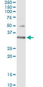 HUS1 Antibody in Immunoprecipitation (IP)