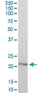 HYAL1 Antibody in Western Blot (WB)