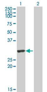 HYAL1 Antibody in Western Blot (WB)