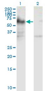 ICA1 Antibody in Western Blot (WB)