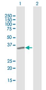 ICAM4 Antibody in Western Blot (WB)