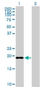 ICT1 Antibody in Western Blot (WB)