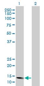 ID2 Antibody in Western Blot (WB)