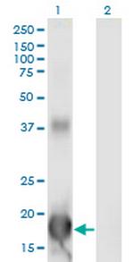 ID4 Antibody in Western Blot (WB)