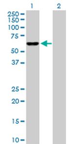 IDH3B Antibody in Western Blot (WB)