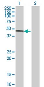 IDH3G Antibody in Western Blot (WB)