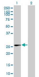 IDI1 Antibody in Western Blot (WB)