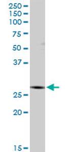 IDI1 Antibody in Western Blot (WB)