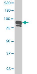 IFI16 Antibody in Western Blot (WB)