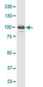 IFI16 Antibody in Western Blot (WB)