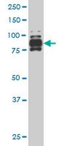 IFI16 Antibody in Western Blot (WB)