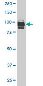 IFI16 Antibody in Western Blot (WB)