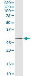 IFNA2 Antibody in Western Blot (WB)