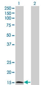 IFNA2 Antibody in Western Blot (WB)