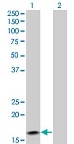 IFNA2 Antibody in Western Blot (WB)