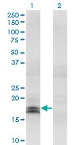IFNA2 Antibody in Western Blot (WB)