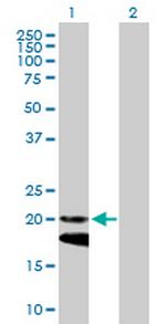 IFNA4 Antibody in Western Blot (WB)