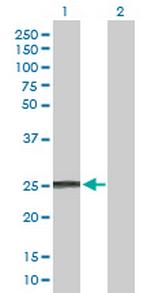 IFNA8 Antibody in Western Blot (WB)