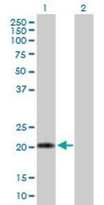 IFNA10 Antibody in Western Blot (WB)