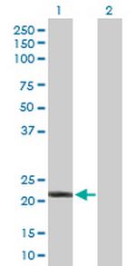 IFNA10 Antibody in Western Blot (WB)